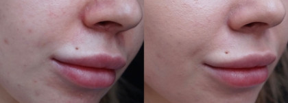 Абсолютное совершенство! Тональный крем Lumene Cc Color Correcting Cream light