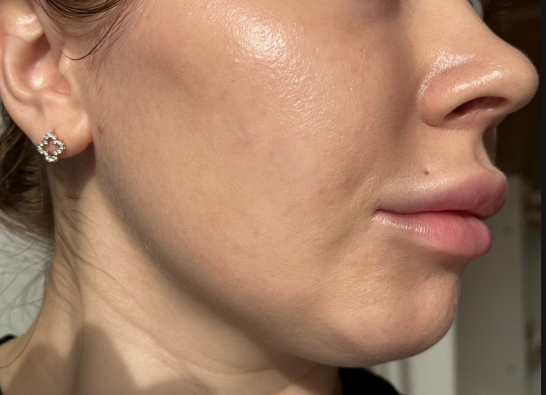 Dior Forever Skin Perfect Stick 1N на солнце