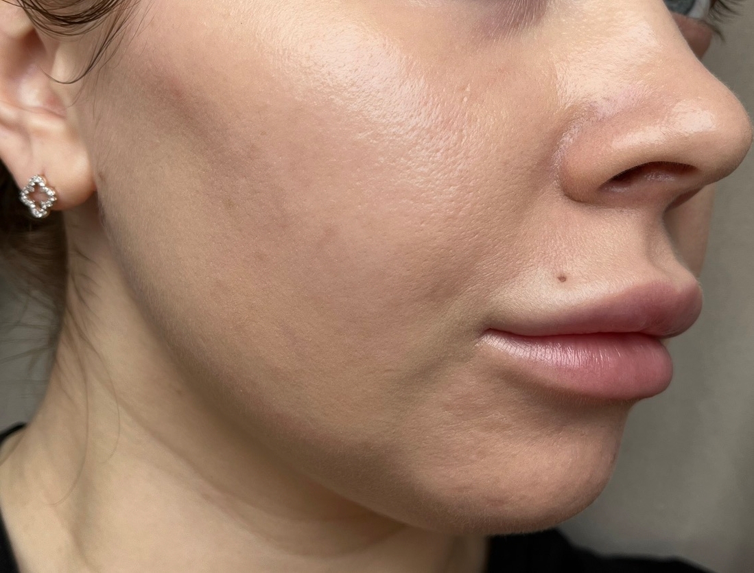 Dior Forever Skin Perfect Stick 1N в тени.