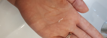 Mixa: бюджетный уход для проблемной кожи да или нет?