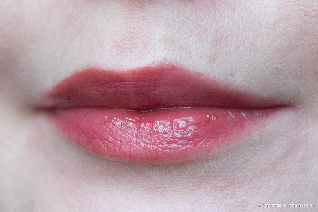 А вот так он и лежит на корках: активность пигмента в целом не сильно выше на самых сухих участках, но на травмированных местах как будто бы остаётся меньше цвета.