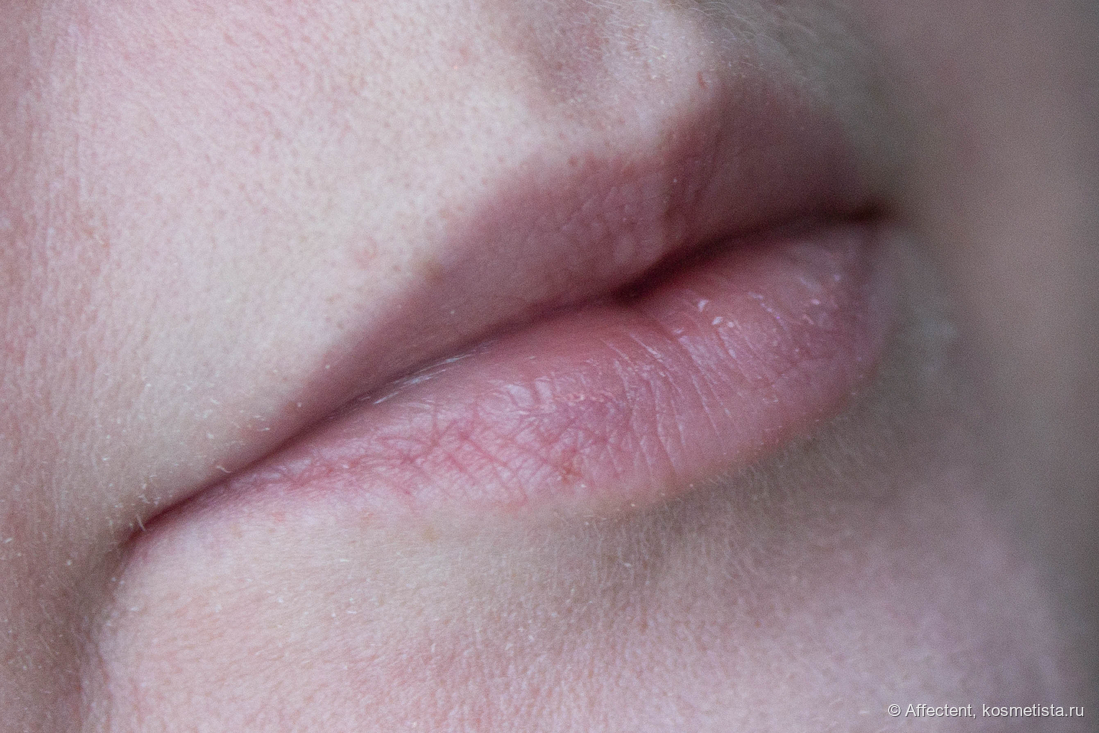 "Голые" губы — для меня это идеальное состояние, но в общем-то проблемы есть