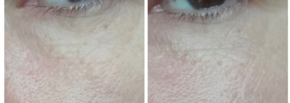 Крем для век Librederm Коллаген омолаживающий. Каков результат на коже 40+?