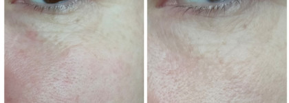 Крем для век Librederm Коллаген омолаживающий. Каков результат на коже 40+?