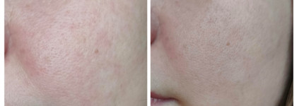 Icon Skin Glow Skin Exfoliating Enzyme Mask - для весеннего обновления кожи