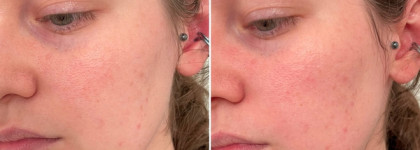 Не всё то хорошо, что из Кореи. Моя сомнительная покупка: A'PIEU Apple Acid Visible Peeling Gel