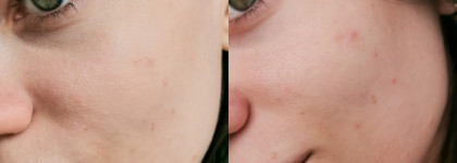 Знакомство с российским брендом Art&Fact: мицеллярная вода, пилинг пэды и увлажняющий крем для лица