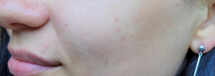 Простые принципы моего базового ухода: очищение, отшелушивание и увлажнение