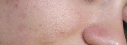 Мицеллярная вода для самых нежных: La messange Eau Micellaire