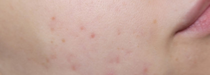 Чистые поры с Энзимной Пектиновой Маской от Гельтек