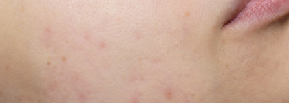 Что там у Mixit? Большой обзор на уход для лица