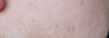 Капсулы красоты Mishipy: f12, f13 и f17