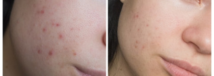 Составляем идеальный уход для кожи лица вместе с Frndly Beauty