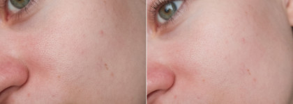 На страже молодости. Крем с пептидами, сыворотка с витамином С и кислотный тоник от Lamar