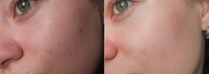 Кожа, как у дочери маминой подруги. Skinjestique: сыворотка с ретиналем, тонер и санскрин