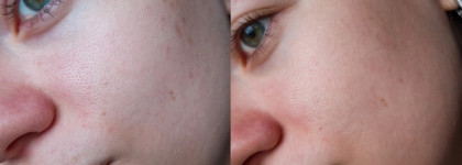 Антивозрастное комбо от Frndly beauty: ретиналь и крем для кожи вокруг глаз с пептидами