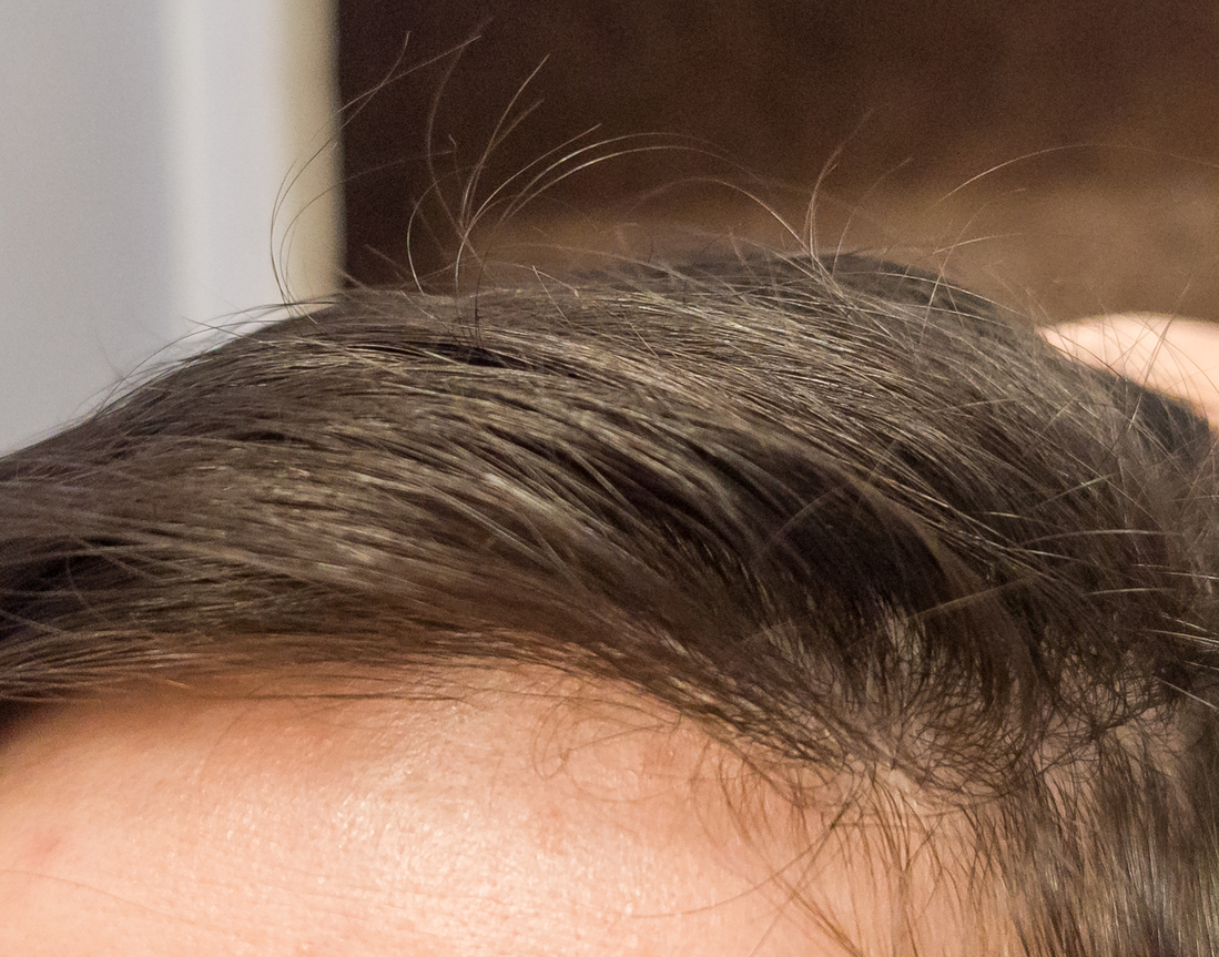 То, что торчит - это новые волоски