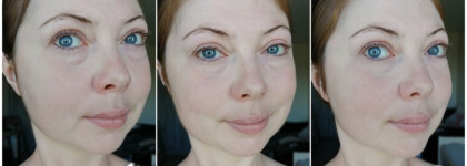 Постоянная отёчность лица, и что с этим делать? Мои ежедневные процедуры и экстренные способы избавления от отёчности