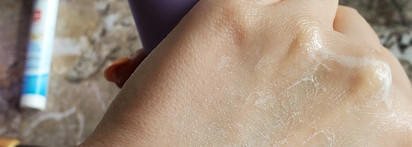 Уход сезона'22: как за 1 неделю "вылечить" раздражение на коже?