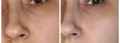 Frudia Blueberry Hydrating Cream: любовь из пробника длиною в ...?