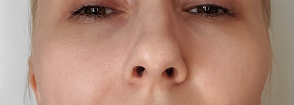 Минеральная Bb-Пудра Icon Skin Glow Star: 3 в 1 - красивая, здоровая заблюренная кожа или нет?