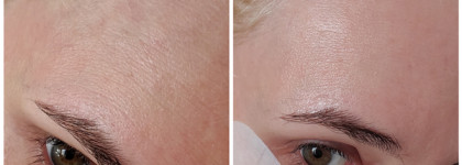 От лёгкого ожога за ночь и от проблем на коже за 1 неделю: крем c Wow-Эффектом Uriage Cica-Cream Copper-Zinc SPF 50+ и его недостатки