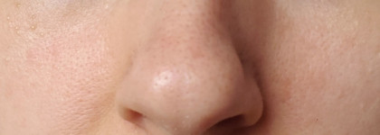 Лучший крем для жирной кожи с акне Витекс #ClearSkin