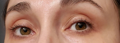 Плюс увлажнение, минус акне: SVR Sebiaclear Hydra Anti-Marks Soothing Repairing Moisturizer