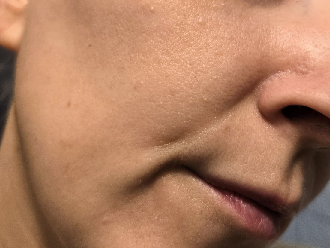 Кожа через 30 минут после нанесения крема