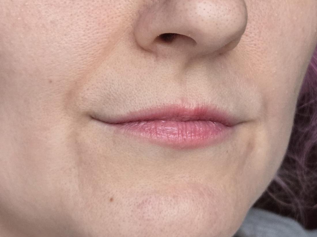 мои губы до нанесения средств, сухие из жары дома, холода на улице и болезни