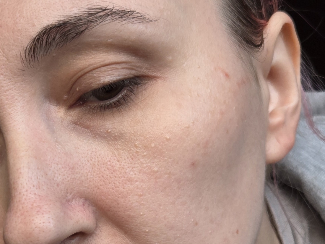 кожа после нанесения тонера