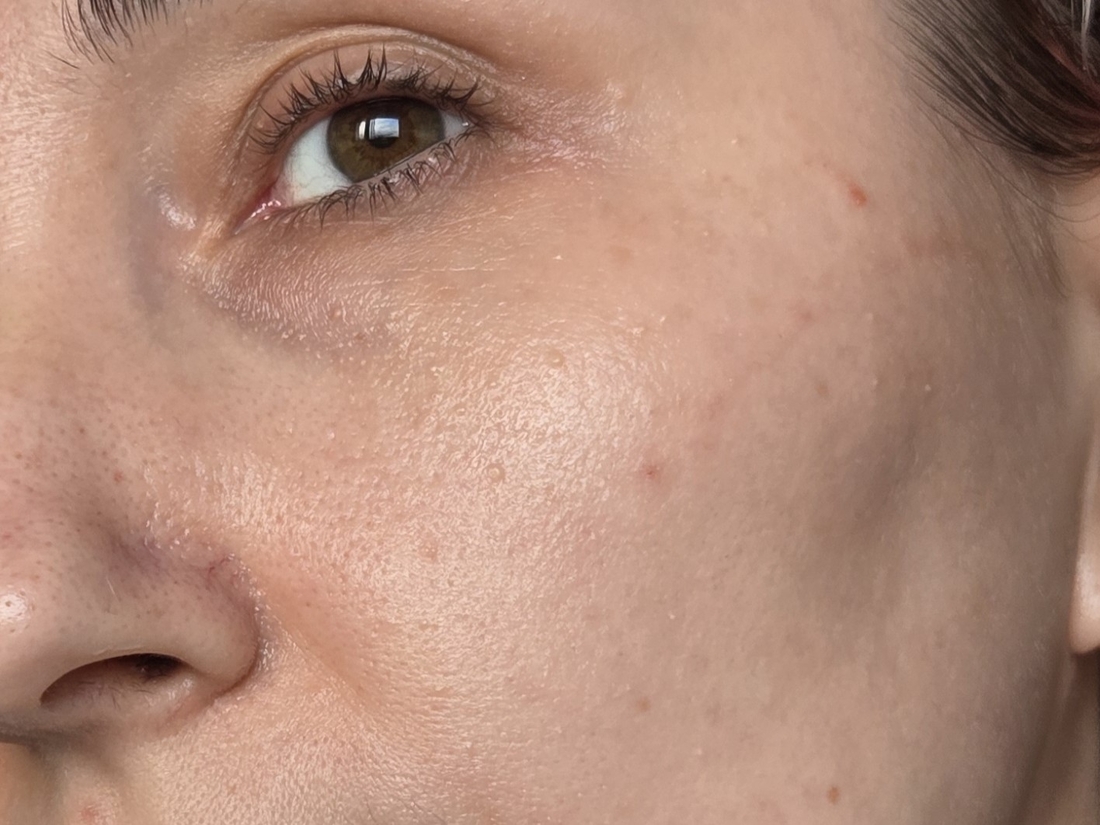 после крема при дневном свете