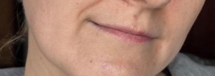 Бархатную кожу заказывали? SVR Sensifine Hydra-Creme Moisturising Smoothing Cream