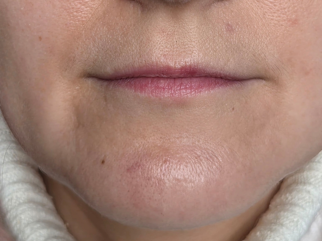 слева нет конслинера, справа в один лёгкий слой.