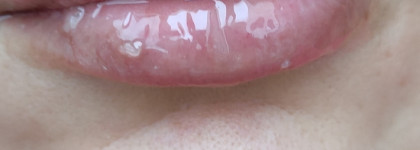 Три способа спасти губы зимой