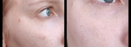 Сыворотка SkinLover с пробиотиками от SP by SkinProbiotic