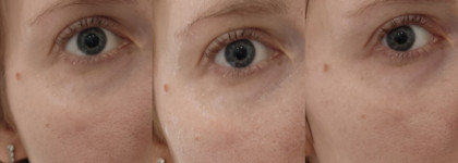 Гель для умывания с салициловой кислотой Vichy Normaderm Phytosolution Intensive Purifying Gel