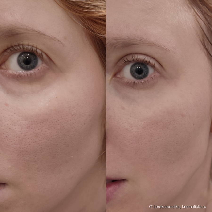 До и после применения глиняной маски