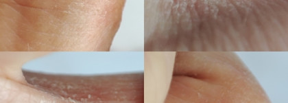 Успокаивающий восстанавливающий бальзам Cicaplast Baume B5+ La Roche-Posay. Грустная история кожи моих рук