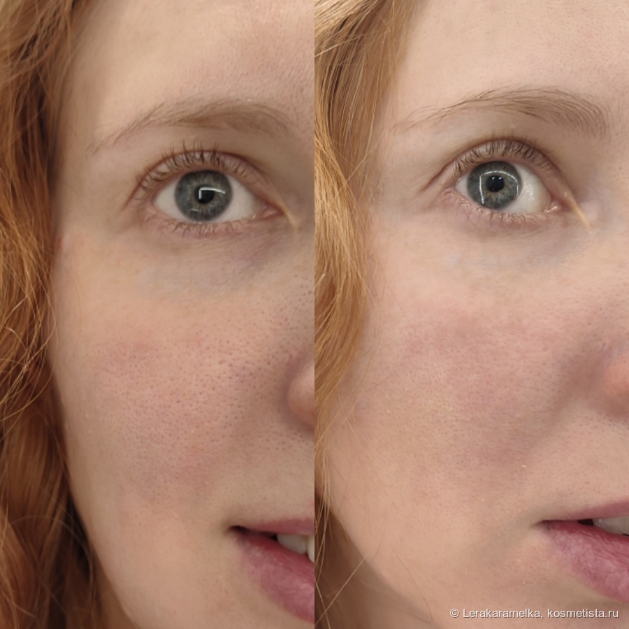 Слева до нанесения вв-крема, а справа-после