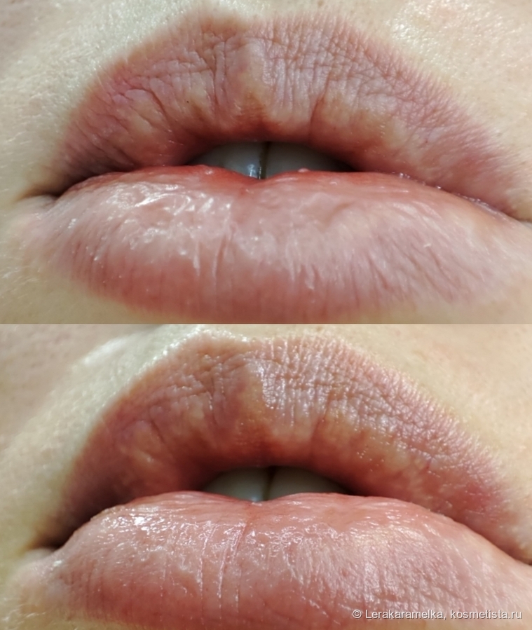 Губы до и через 15 минут после нанесения вазелина Бархатные ручки