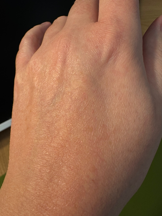 Кожа до нанесения крема (искусственный свет)