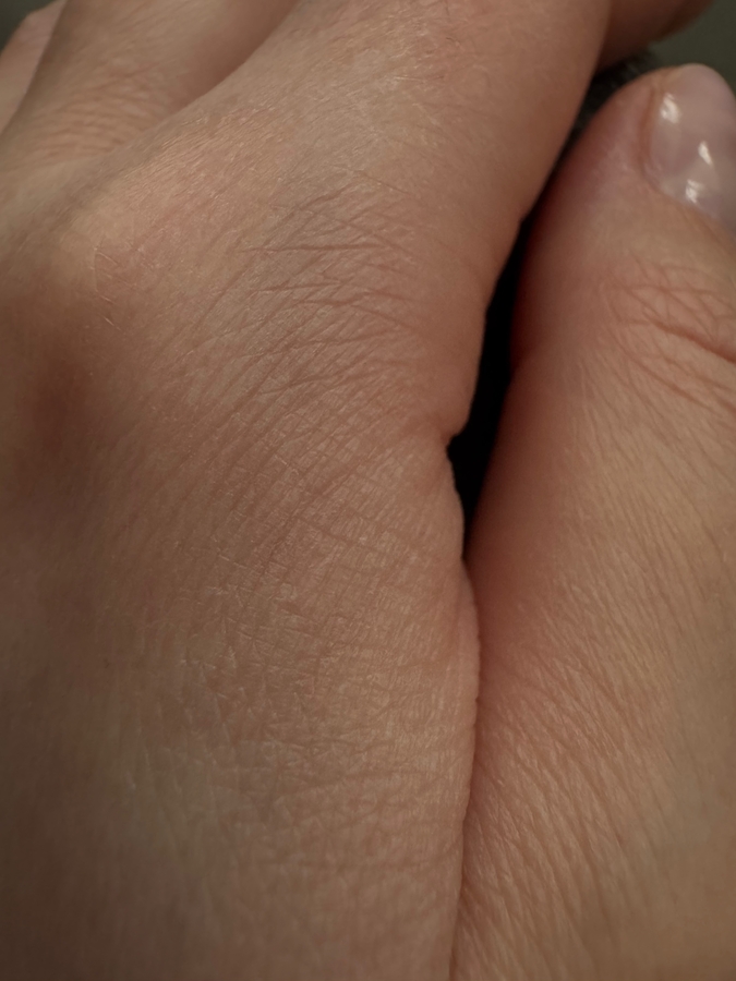 Кожа до нанесения крема (дневной свет). Я подготовилась - кожа сухая))