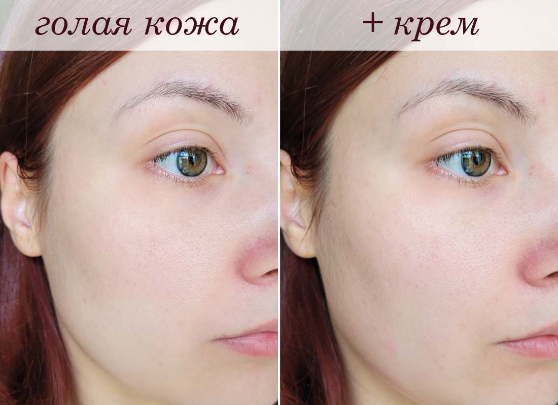 До/после