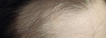 Почини мои волосы. Ампулы для волос Vichy Dercos Technique Aminexil Intensive 5