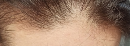 Почини мои волосы. Ампулы для волос Vichy Dercos Technique Aminexil Intensive 5