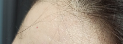 Почини мои волосы. Ампулы для волос Vichy Dercos Technique Aminexil Intensive 5