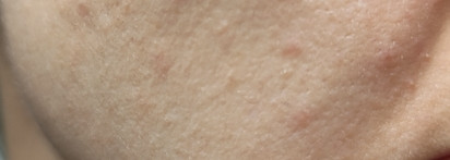 С открытым лицом. Три средства от Openface для проблемной кожи