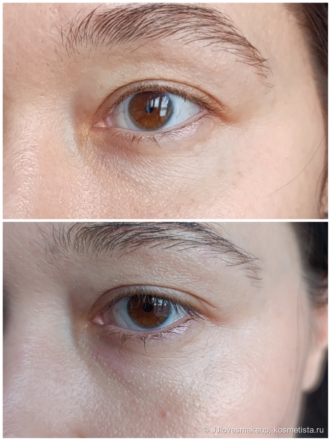 Снизу "до", сверху "после", разница в фото- пара недель