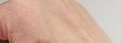 Зимний уход за губами